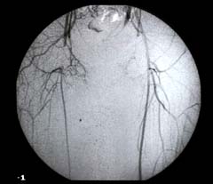 A digital angiogram